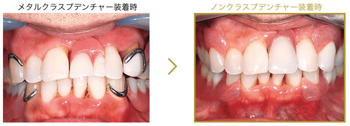エステショットブライト