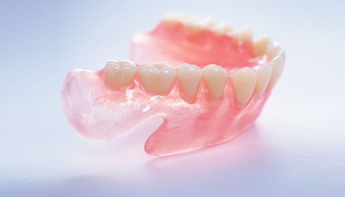 ノンクラスプデンチャー