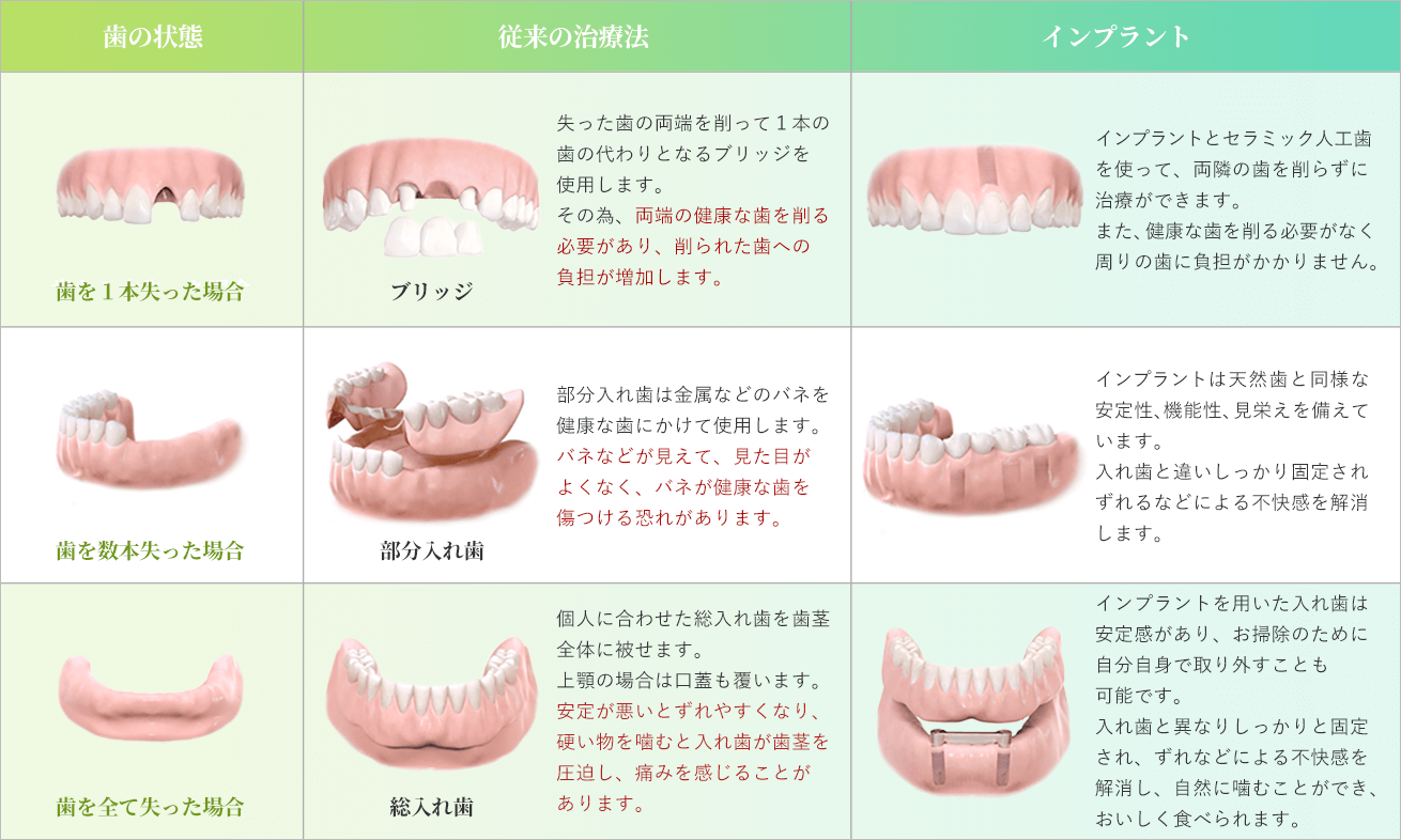 インプラントと従来の治療法の比較