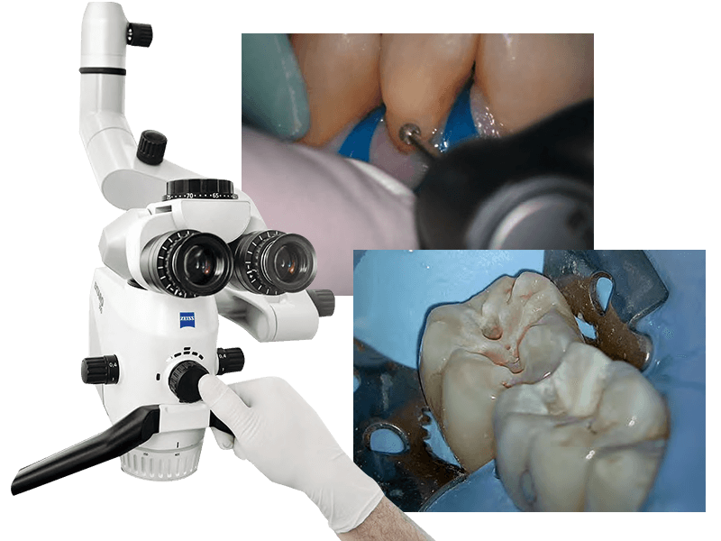 マイクロスコープ