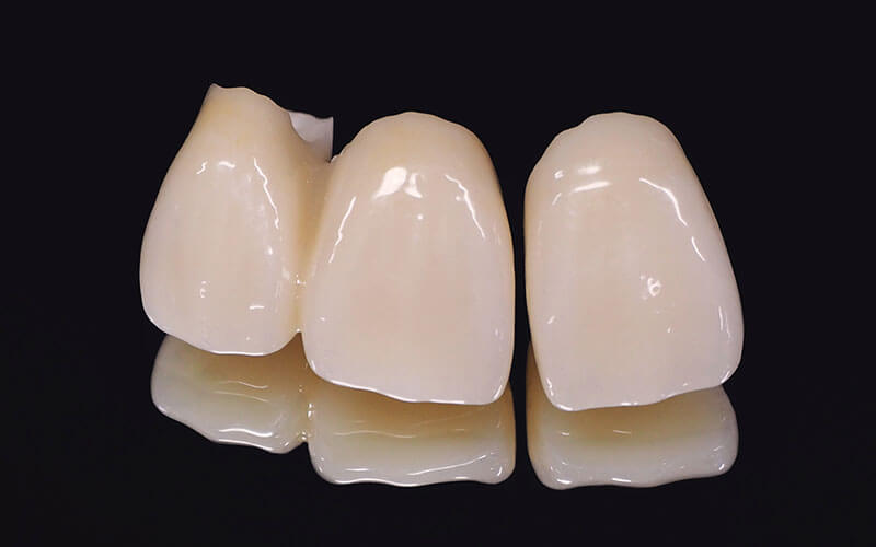 セラミック治療