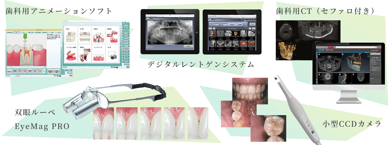 視覚的アプローチ